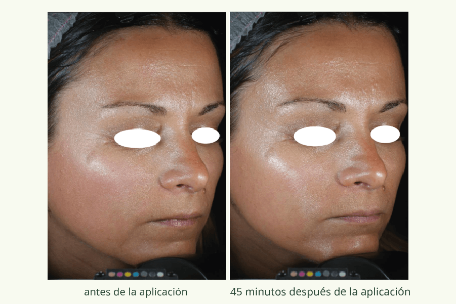 Collagene Vegetale 1