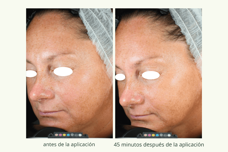 Collagene Vegetale 2